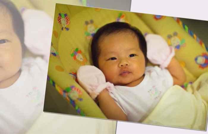 Sống khỏe 360 -  Vàng da ở trẻ sơ sinh (17-11-2020)